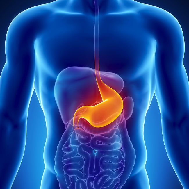 GASTRIC CANCER